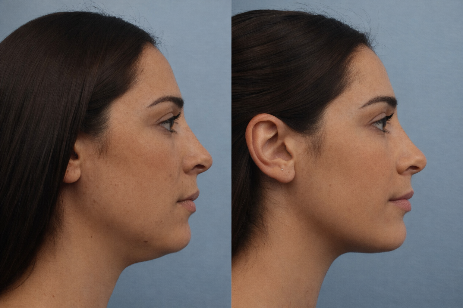 Before and after comparison